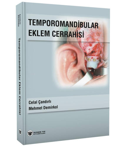 Temporomandibular Eklem Cerrahisi